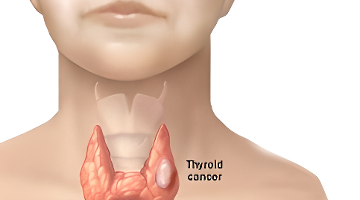 The nutritional value of taro meat_How to make taro meat_The steps of making taro meat